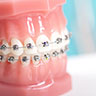 矯正歯科治療
